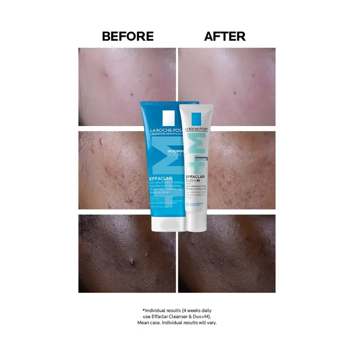 LA ROCHE-POSAY Effaclar Duo+ M - 40ml4.webp