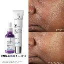 La Roche Posay Mela B3 UV Daily Moisturizer SPF 30 With Melasyl™ + Niacinamide - 40ml5.webp