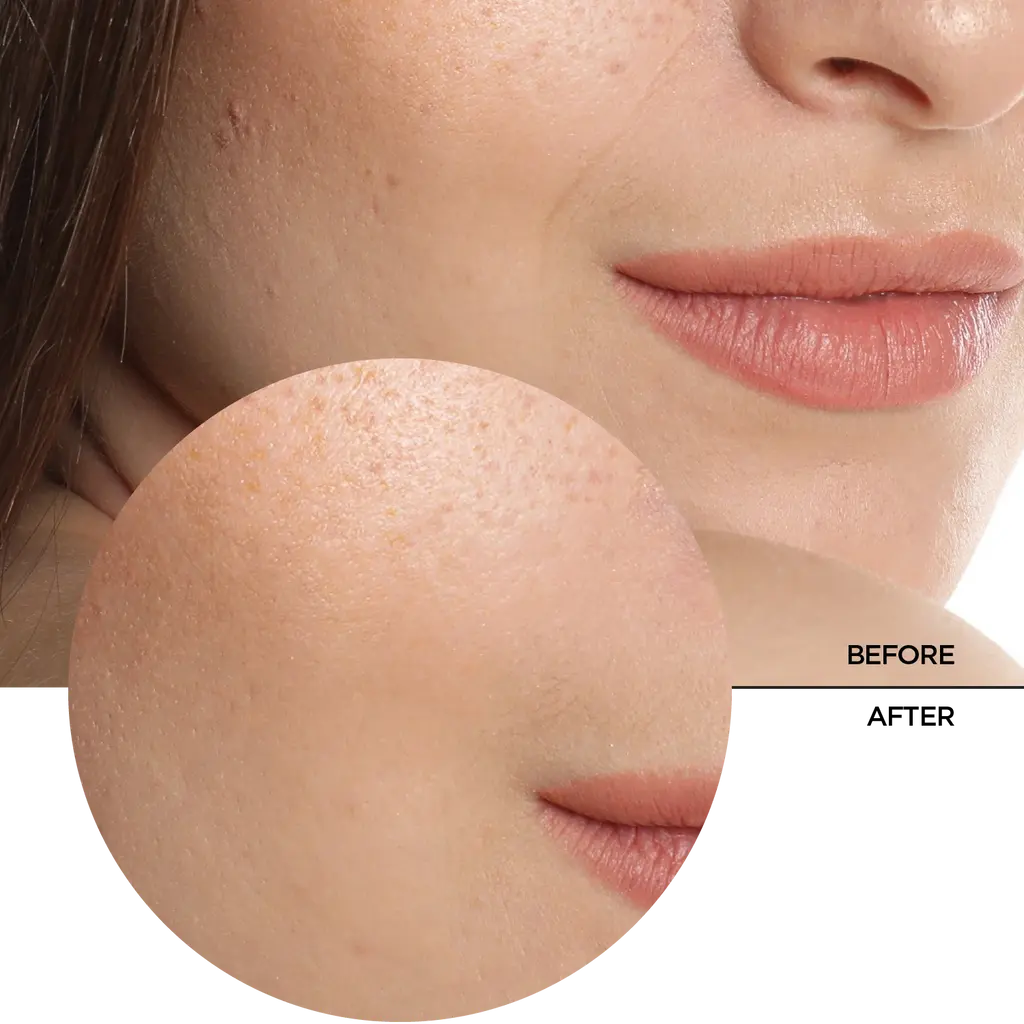 REVOX Just Hyaluronic Acid 5% - 30 ml6.webp