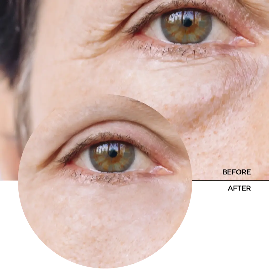 Revox Just Caffeine 5% Eye Contour Serum - 30 ml6.webp