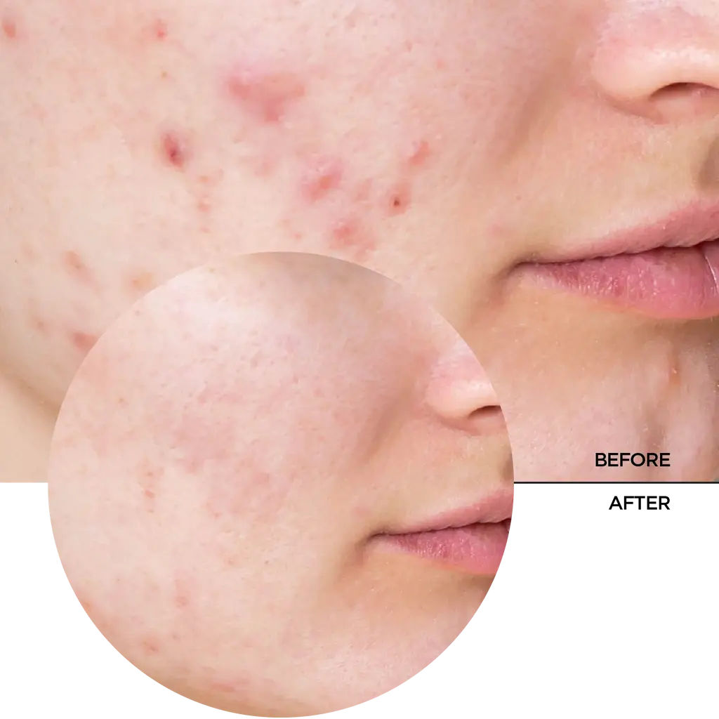 REVOX JUST NIACINAMID Daily Moisturiser 30ml6.webp