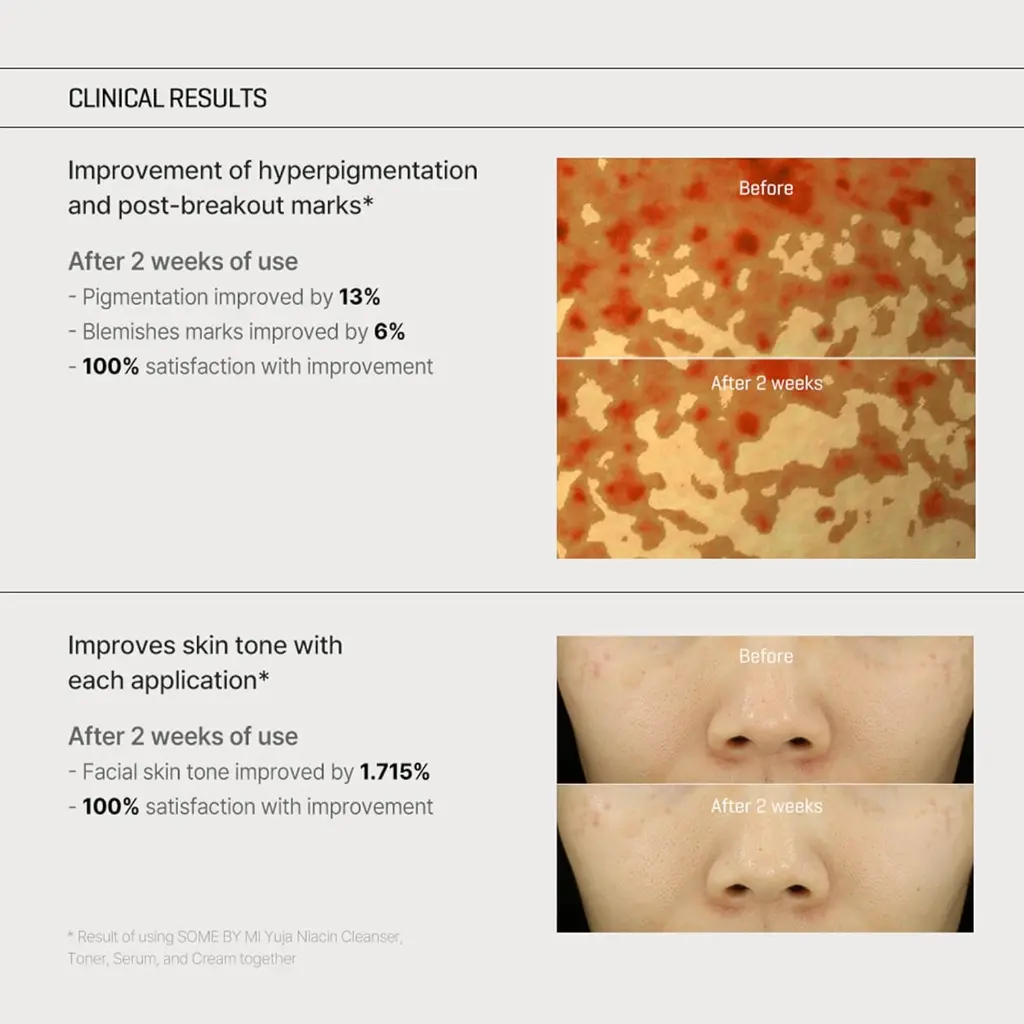 Some By Mi Yuja Niacin Anti Blemish Cream - 60g6.webp