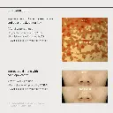Some By Mi Yuja Niacin Anti Blemish Cream - 60g6.webp