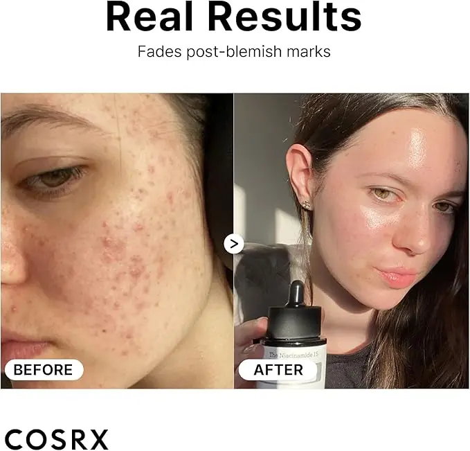 Cosrx The Niacinamide 15 Serum2.webp