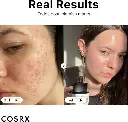 Cosrx The Niacinamide 15 Serum2.webp